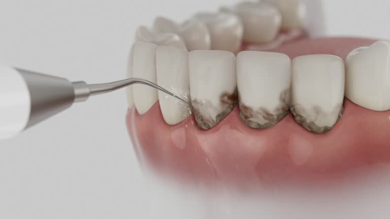 Trusted Emergency Dentist service in Pierre, SD - Dentist Open Now